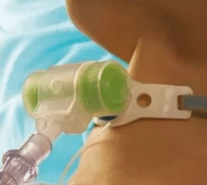 Hydro Trach T HME Filter
