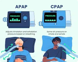 APAP vs CPAP